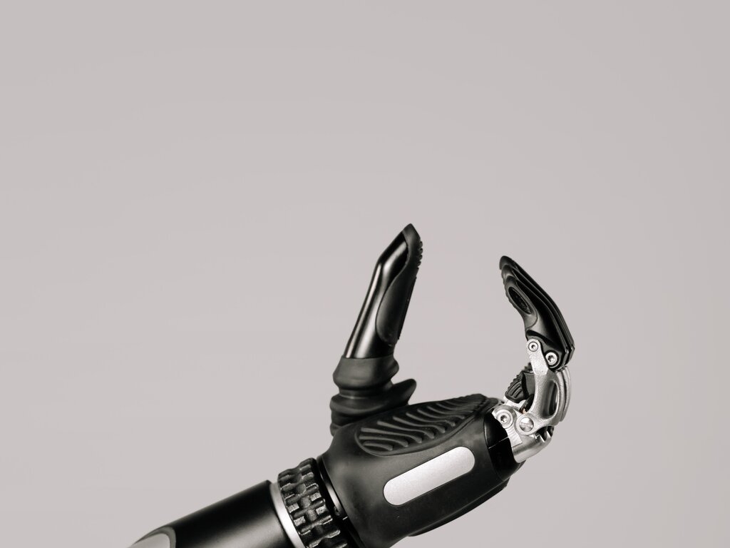 Technologically advanced robotic arm prosthesis Technologically advanced robotic arm prosthesis